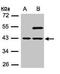 Snurportin-1 antibody, GTX108022, GeneTex, Western Blot image 