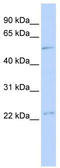 TFDP1 antibody, TA330410, Origene, Western Blot image 