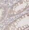 Alpha-2-Macroglobulin antibody, FNab10346, FineTest, Immunohistochemistry paraffin image 