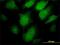 Proprotein Convertase Subtilisin/Kexin Type 1 antibody, H00005122-M02, Novus Biologicals, Immunocytochemistry image 