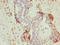 NOP10 Ribonucleoprotein antibody, LS-C397371, Lifespan Biosciences, Immunohistochemistry paraffin image 