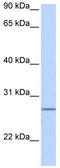 GrpE Like 2, Mitochondrial antibody, TA338840, Origene, Western Blot image 