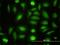 Probable aminopeptidase NPEPL1 antibody, H00079716-M01, Novus Biologicals, Immunocytochemistry image 