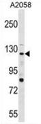 Protein Tyrosine Phosphatase Receptor Type N2 antibody, AP53516PU-N, Origene, Western Blot image 