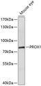 Prospero homeobox protein 1 antibody, 14-515, ProSci, Western Blot image 