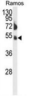 Fc Receptor Like 4 antibody, AP51644PU-N, Origene, Western Blot image 