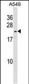 Heat Shock Protein Family B (Small) Member 9 antibody, PA5-49139, Invitrogen Antibodies, Western Blot image 