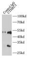 Collagen Triple Helix Repeat Containing 1 antibody, FNab02055, FineTest, Immunoprecipitation image 