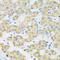 Monocarboxylate transporter 5 antibody, A14818, ABclonal Technology, Western Blot image 