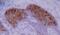 Keratin 10 antibody, LS-C45752, Lifespan Biosciences, Immunohistochemistry paraffin image 