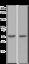 Cytochrome P450 Family 3 Subfamily A Member 5 antibody, ab108624, Abcam, Western Blot image 