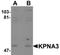 Karyopherin Subunit Alpha 3 antibody, TA319673, Origene, Western Blot image 