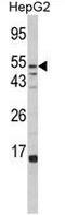Alpha-L-Fucosidase 1 antibody, GTX81717, GeneTex, Western Blot image 