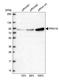 Protein phosphatase 1G antibody, HPA035530, Atlas Antibodies, Western Blot image 