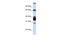 Arginase 1 antibody, ARP45671_P050, Aviva Systems Biology, Western Blot image 