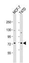 HERV-K_6q14.1 provirus ancestral Env polyprotein antibody, MBS9216894, MyBioSource, Western Blot image 