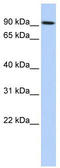 Protein-glutamine gamma-glutamyltransferase K antibody, TA346179, Origene, Western Blot image 