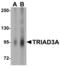 Ring Finger Protein 216 antibody, NBP1-76592, Novus Biologicals, Western Blot image 