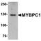 Myosin Binding Protein C, Slow Type antibody, TA319685, Origene, Western Blot image 