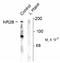 Glutamate Ionotropic Receptor NMDA Type Subunit 2B antibody, NB100-61103, Novus Biologicals, Western Blot image 