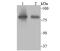 Aconitase antibody, A03096, Boster Biological Technology, Western Blot image 