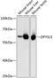 Dihydropyrimidinase Like 5 antibody, 13-775, ProSci, Western Blot image 