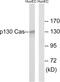 BCAR1 Scaffold Protein, Cas Family Member antibody, LS-C117569, Lifespan Biosciences, Western Blot image 