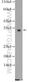 Fibroblast Growth Factor 13 antibody, 25314-1-AP, Proteintech Group, Western Blot image 