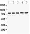 Receptor Interacting Serine/Threonine Kinase 1 antibody, PB9116, Boster Biological Technology, Western Blot image 
