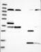 Mitochondrial GTPase 1 antibody, NBP1-81789, Novus Biologicals, Western Blot image 