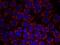ERBB2 antibody, NB100-81957, Novus Biologicals, Immunofluorescence image 