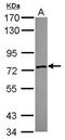 Zinc Finger SWIM-Type Containing 2 antibody, GTX118963, GeneTex, Western Blot image 
