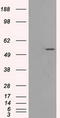 Solute Carrier Family 2 Member 5 antibody, LS-C797093, Lifespan Biosciences, Western Blot image 
