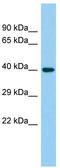 Chromosome 4 Open Reading Frame 17 antibody, TA331696, Origene, Western Blot image 