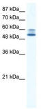 Lysine-specific demethylase 4D antibody, TA339502, Origene, Western Blot image 