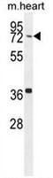 Coiled-coil domain-containing protein 38 antibody, AP50777PU-N, Origene, Western Blot image 