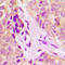 DEAD-Box Helicase 55 antibody, LS-C358466, Lifespan Biosciences, Immunohistochemistry paraffin image 