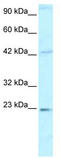 High Mobility Group Box 2 antibody, TA329706, Origene, Western Blot image 