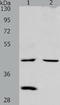 Neutral cholesterol ester hydrolase 1 antibody, TA323967, Origene, Western Blot image 