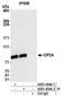 Protein CIP2A antibody, A301-454A, Bethyl Labs, Immunoprecipitation image 