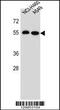 Leucine-rich repeat-containing protein 6 antibody, 56-024, ProSci, Western Blot image 