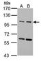Unc-51 Like Autophagy Activating Kinase 2 antibody, TA308622, Origene, Western Blot image 