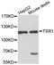 Pre-rRNA-processing protein TSR1 homolog antibody, A4842, ABclonal Technology, Western Blot image 