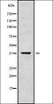 Centromere Protein C antibody, orb337853, Biorbyt, Western Blot image 