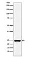 BCL2 Associated Athanogene 2 antibody, M04933, Boster Biological Technology, Western Blot image 