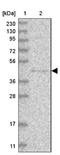 Protein-L-Isoaspartate (D-Aspartate) O-Methyltransferase Domain Containing 1 antibody, NBP1-83817, Novus Biologicals, Western Blot image 
