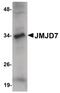 Jumonji Domain Containing 7 antibody, PA5-20809, Invitrogen Antibodies, Western Blot image 