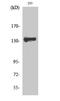 Zinc Finger And BTB Domain Containing 40 antibody, A11168-2, Boster Biological Technology, Western Blot image 