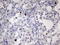 Hdm2 antibody, LS-C339270, Lifespan Biosciences, Immunohistochemistry paraffin image 