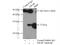 Type II HADH antibody, 10648-1-AP, Proteintech Group, Immunoprecipitation image 